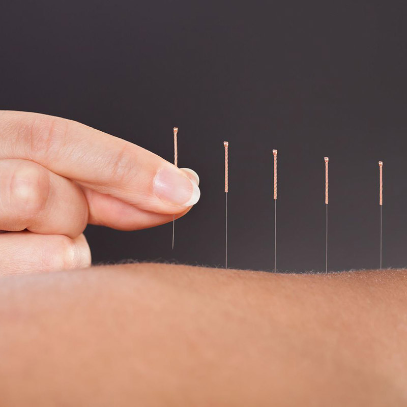 Medical Acupuncture - Utilizing the knowledge of anatomy and physiology.